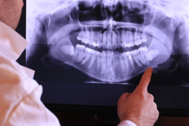 Best Emergency TMJ Treatment in Bristow, OK
